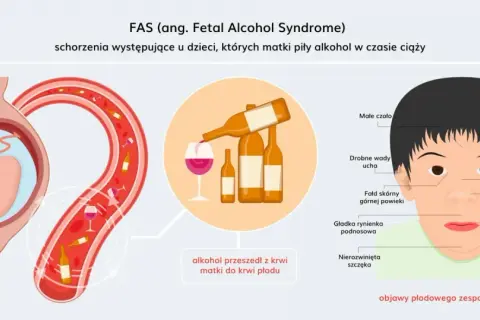 FASD - alkohol przeszedł z krwi matki do krwi płodu, powodując charakterystyczne cechy u noworodka.