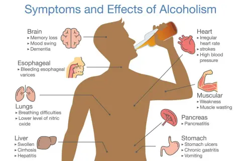 Ilustracja pokazuje objawy i skutki picia alkoholu, w tym nieodwracalne skutki dla mózgu, serca, płuc, wątroby, trzustki, żołądka i mięśni.
