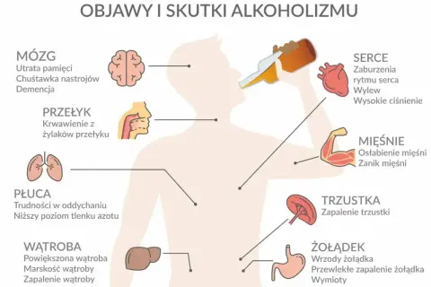 Alkohol niszczy mózg, serce, płuca, wątrobę, żołądek i mięśnie. Ilustracja pokazuje objawy i skutki alkoholizmu.
