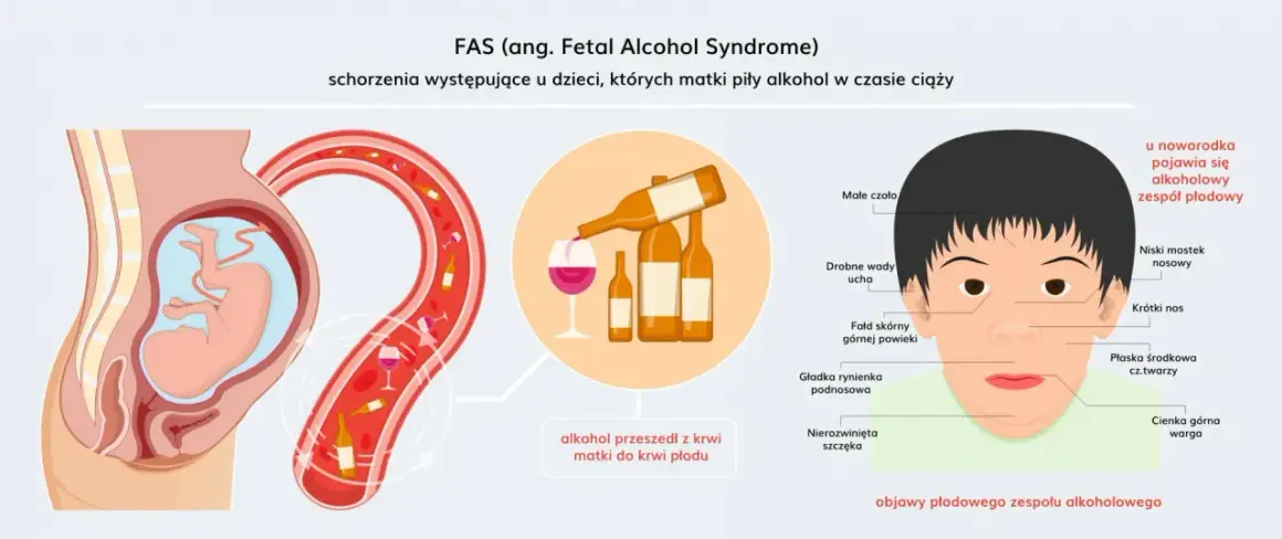 FASD - alkohol przeszedł z krwi matki do krwi płodu, powodując charakterystyczne cechy u noworodka.