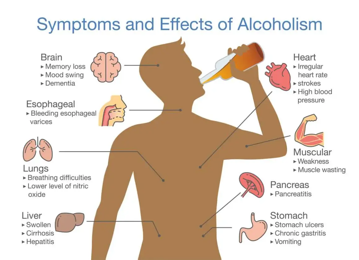 Ilustracja pokazuje objawy i skutki picia alkoholu, w tym nieodwracalne skutki dla mózgu, serca, płuc, wątroby, trzustki, żołądka i mięśni.