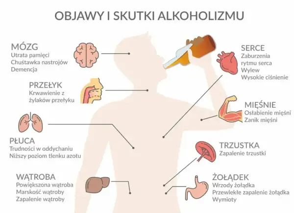 Alkohol niszczy mózg, serce, płuca, wątrobę, żołądek i mięśnie. Ilustracja pokazuje objawy i skutki alkoholizmu.