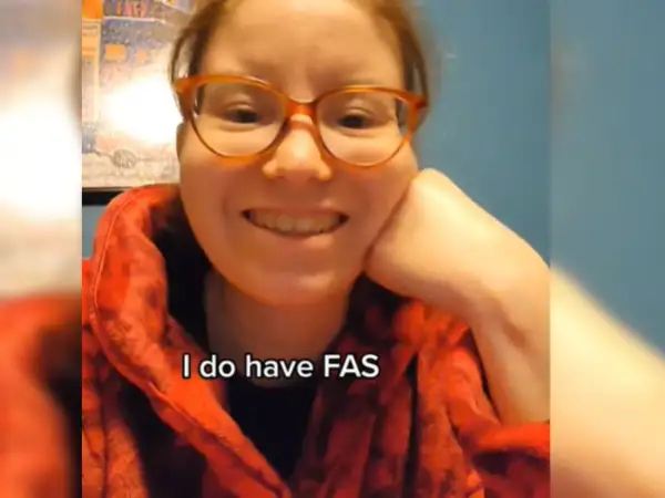 Uśmiechnięta kobieta w okularach mówi: "I do have FAS". Opowiada o FAS u dorosłych.